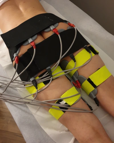 Elektrostymulacja IR